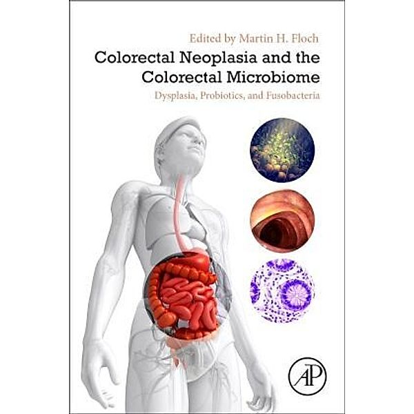 Colorectal Neoplasia and the Colorectal Microbiome