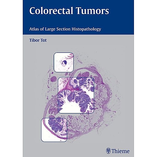 Colorectal Tumors, Tibor Tot