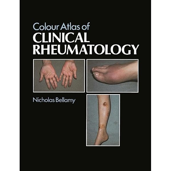 Colour Atlas of Clinical Rheumatology, N. Bellamy