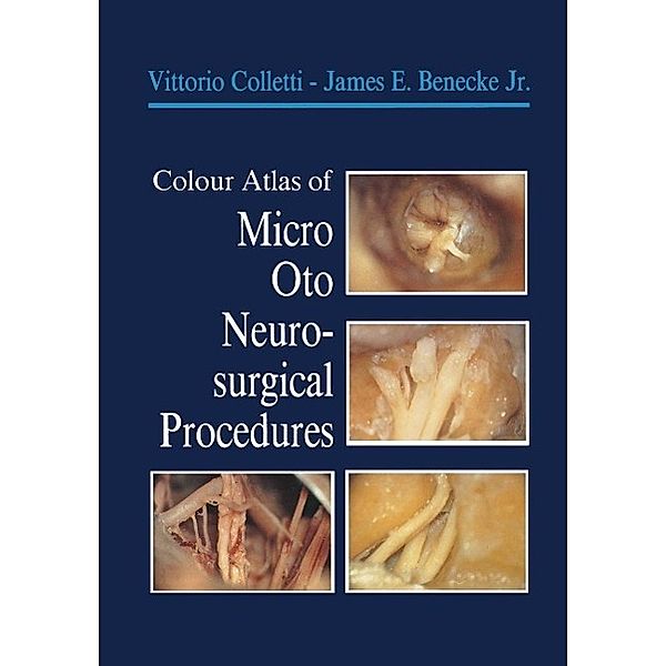 Colour Atlas of Micro-Oto-Neurosurgical Procedures, Vittorio Colletti, James E. Jr. Benecke