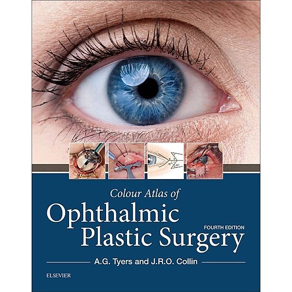 Colour Atlas of Ophthalmic Plastic Surgery E-Book, Anthony G. Tyers, J. R. O. Collin