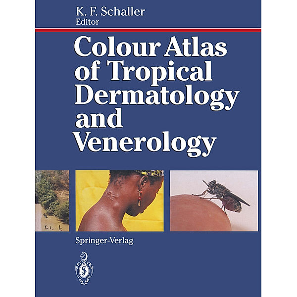 Colour Atlas of Tropical Dermatology and Venerology