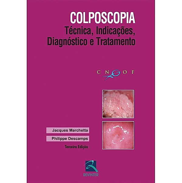 Colposcopia, Jacques Marchetta, Philippe Descamps