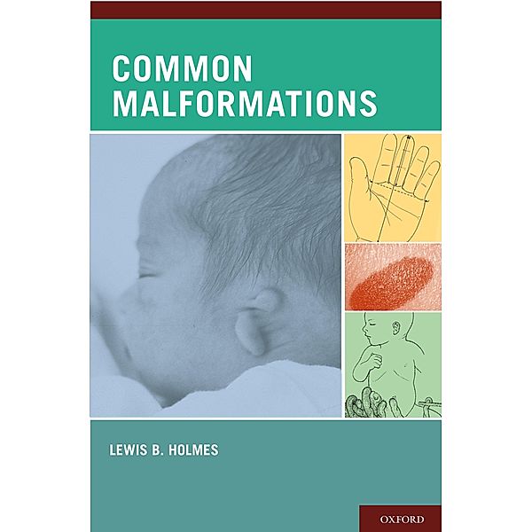 Common Malformations, Lewis B. MD Holmes