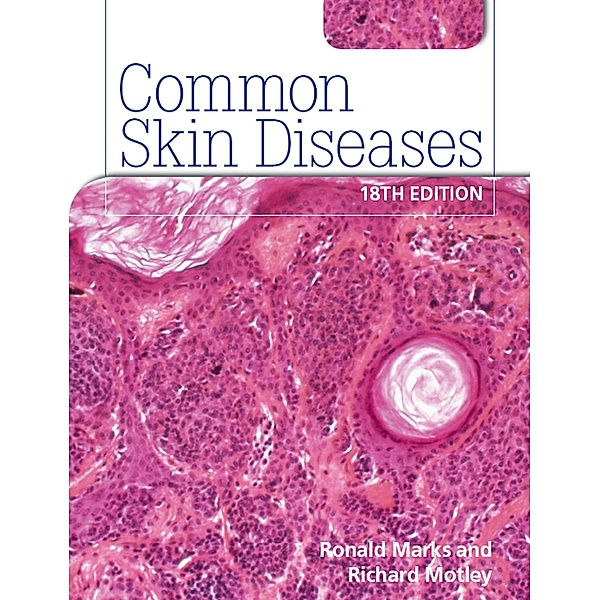 Common Skin Diseases 18th edition, Ronald Marks, Richard Motley
