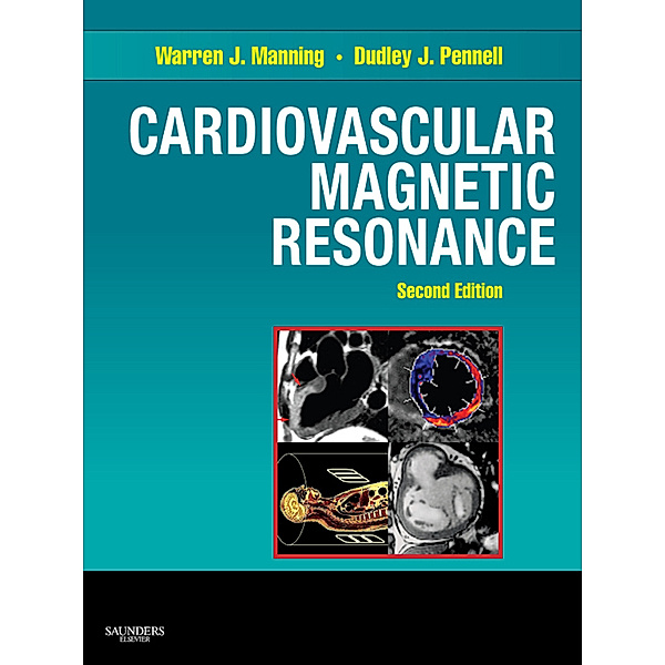 Companion to Braunwald's Heart Disease: Cardiovascular Magnetic Resonance E-Book, Warren J. Manning, Dudley J. Pennell