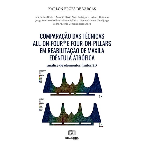 Comparação das técnicas All-On-Four® e Four-On-Pillars em reabilitação de maxila edêntula atrófica, Karlon Fróes de Vargas, Luiz Carlos Gertz, Antonio Flavio Aires Rodrigues, Ahmet Ozkomur