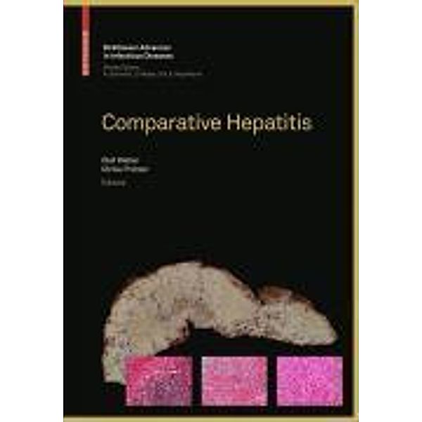 Comparative Hepatitis / Birkhäuser Advances in Infectious Diseases