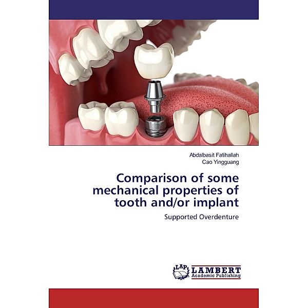 Comparison of some mechanical properties of tooth and/or implant, Abdalbasit Fatihallah, Cao Yingguang