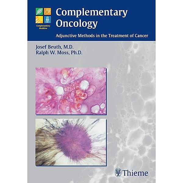 Complementary Oncology, Josef Beuth, Ralph W. Moss
