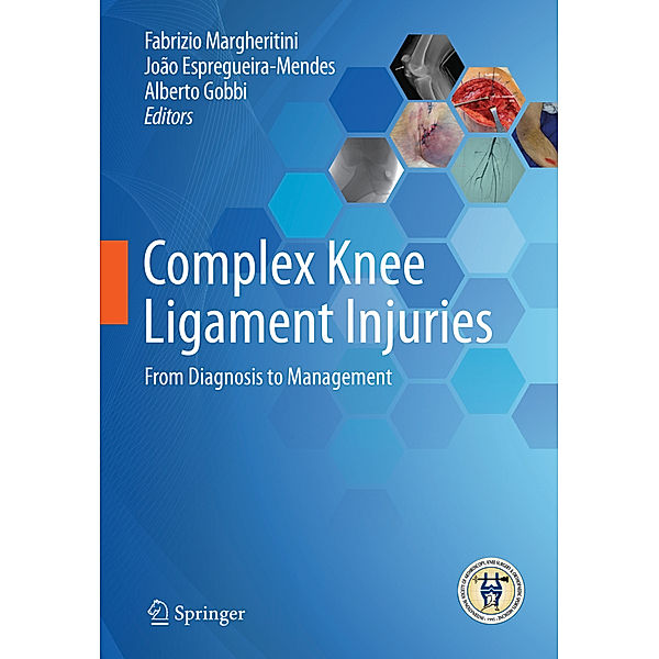 Complex Knee Ligament Injuries