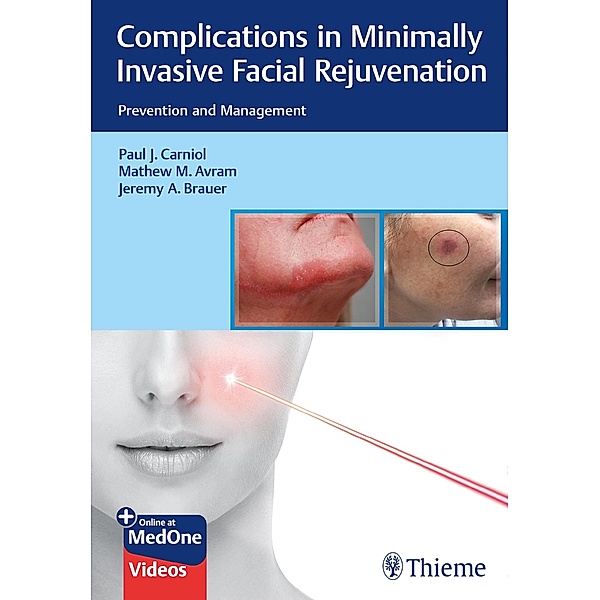 Complications in Minimally Invasive Facial Rejuvenation, Paul J. Carniol, Mathew M. Avram, Jeremy A. Brauer
