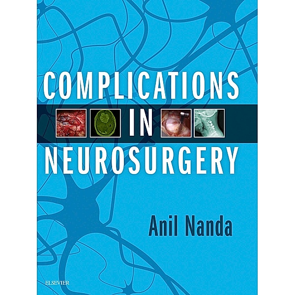 Complications in Neurosurgery E-Book, Anil Nanda