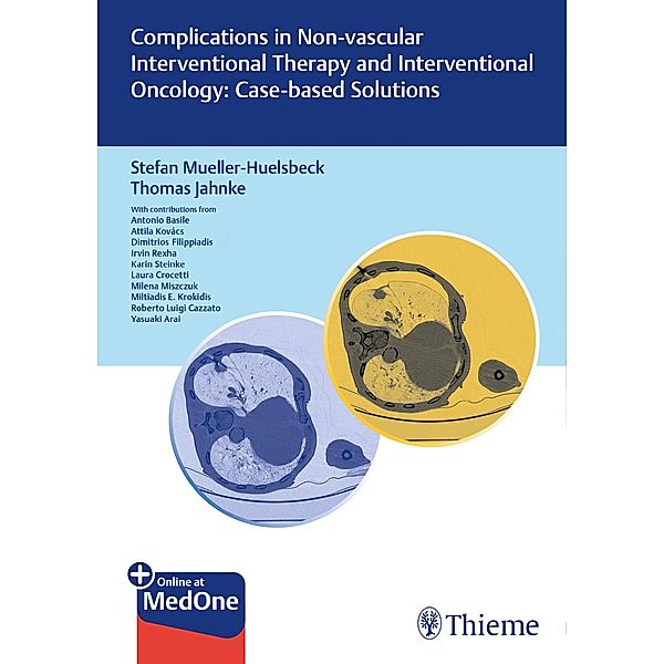 Complications in Non-vascular Interventional Therapy and Interventional Oncology: Case-based Solutions