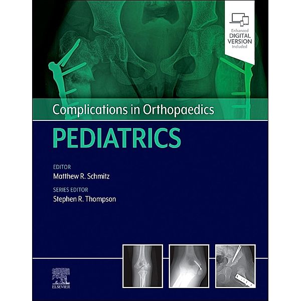 Complications In Orthopaedics: Pediatrics, Matthew Schmitz