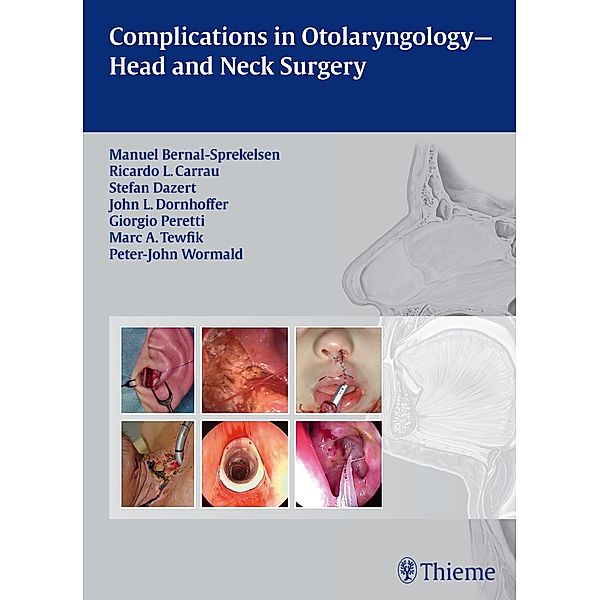 Complications in Otolaryngology - Head and Neck Surgery, Manuel Bernal-Sprekelsen