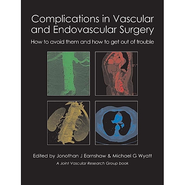 Complications in Vascular and Endovascular Surgery, Jonothan J Earnshaw