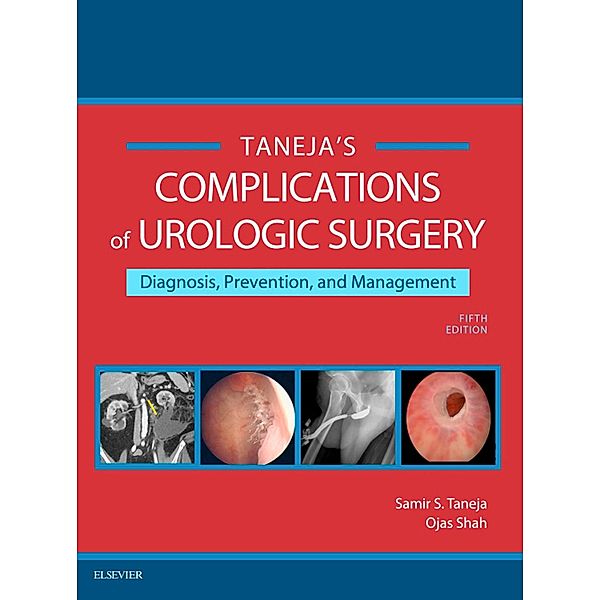 Complications of Urologic Surgery E-Book, Samir S. Taneja, Ojas Shah