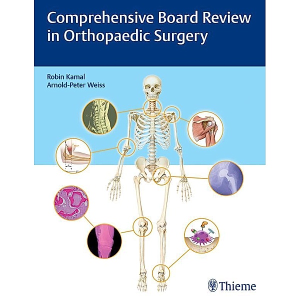 Comprehensive Board Review in Orthopaedic Surgery