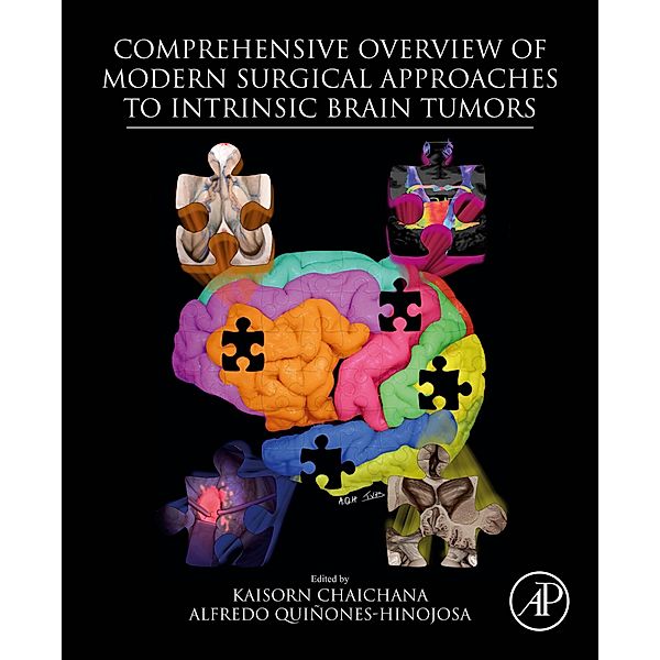 Comprehensive Overview of Modern Surgical Approaches to Intrinsic Brain Tumors