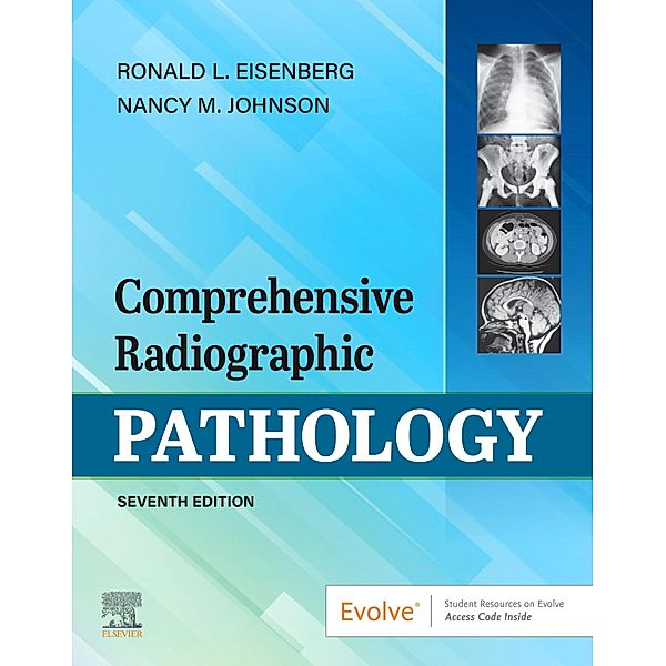 Comprehensive Radiographic Pathology E-Book, Ronald L. Eisenberg, Nancy M. Johnson