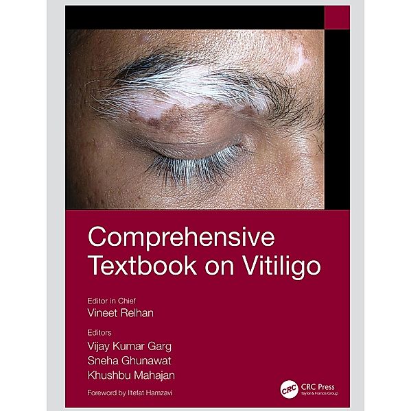 Comprehensive Textbook on Vitiligo