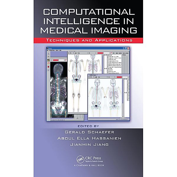 Computational Intelligence in Medical Imaging