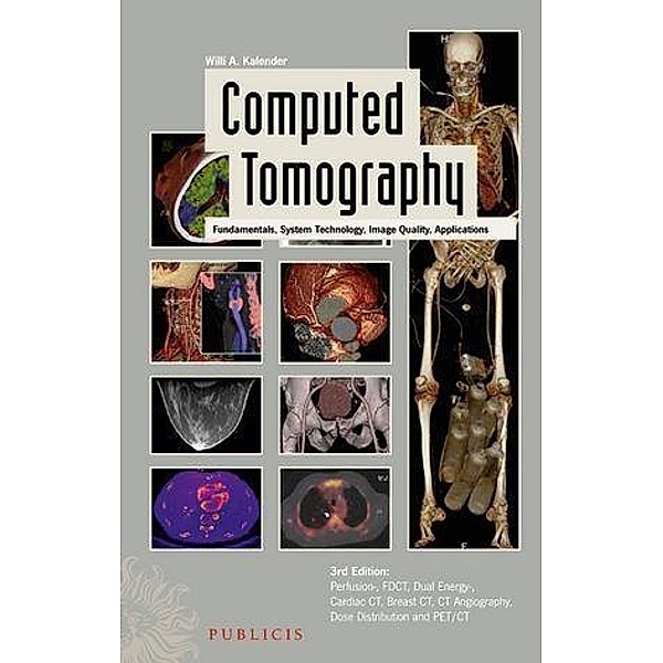 Computed Tomography, Willi A. Kalender