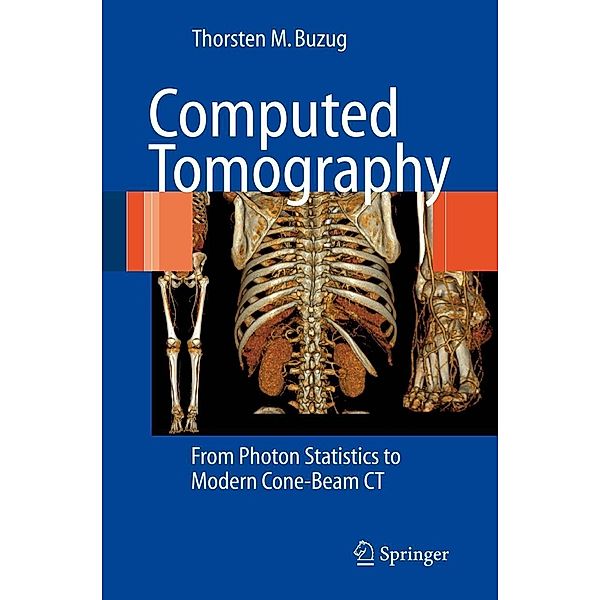 Computed Tomography, Thorsten M. Buzug