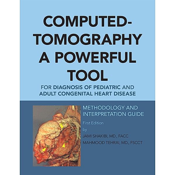 Computed-Tomography a Powerful Tool for Diagnosis of Pediatric and Adult Congenital Heart Disease, Jami G. Shakibi
