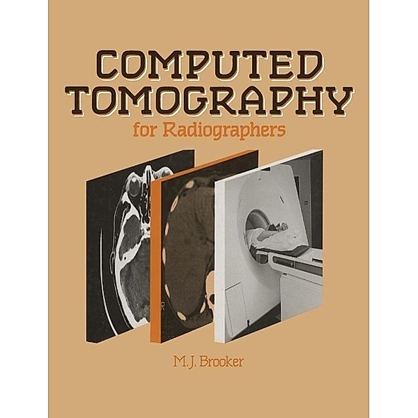 Computed Tomography for Radiographers, M. J. Brooker
