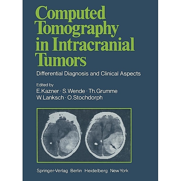 Computed Tomography in Intracranial Tumors, G. B. Bradac, E. Kazner, K. Kretzschmar, W. Lanksch, W. Meese, J. Schramm, H. Steinhoff, O. Stochdorph, S. Wende, U. Büll, R. Fahlbusch, Th. Grumme