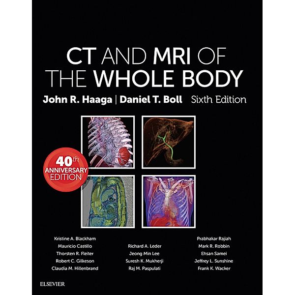 Computed Tomography & Magnetic Resonance Imaging Of The Whole Body E-Book, John R. Haaga, Daniel Boll