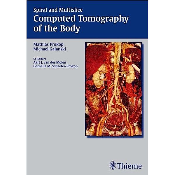 Computed Tomography of the Body, Cornelia M. Prokop