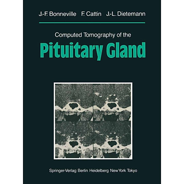 Computed Tomography of the Pituitary Gland, Jean-Francois Bonneville, F. Cattin, Jean-Louis Dietemann