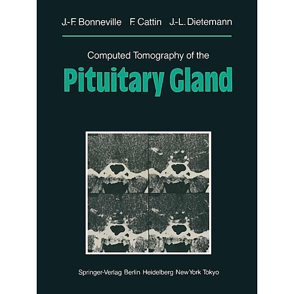 Computed Tomography of the Pituitary Gland, Jean-Francois Bonneville, F. Cattin, Jean-Louis Dietemann