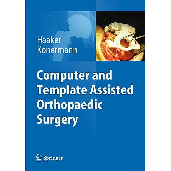 Computer and Template Assisted Orthopedic Surgery