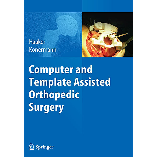 Computer and Template Assisted Orthopedic Surgery