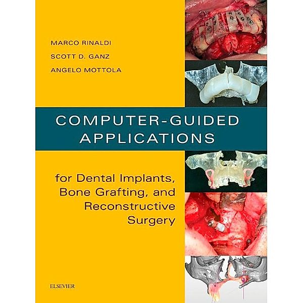 Computer-Guided Dental Implants and Reconstructive Surgery, Marco Rinaldi, Scott D Ganz, Angelo Mottola