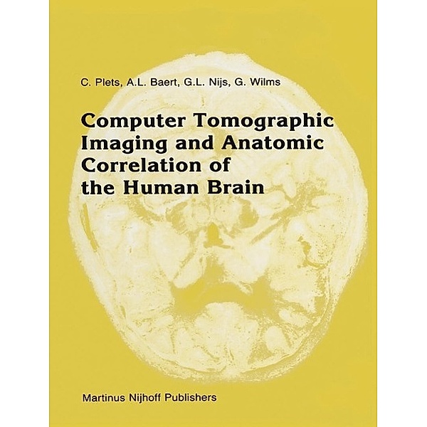 Computer Tomographic Imaging and Anatomic Correlation of the Human Brain / Series in Radiology Bd.13, C. Plets, A. Baert, G. L. Nijs, Guido Wilms