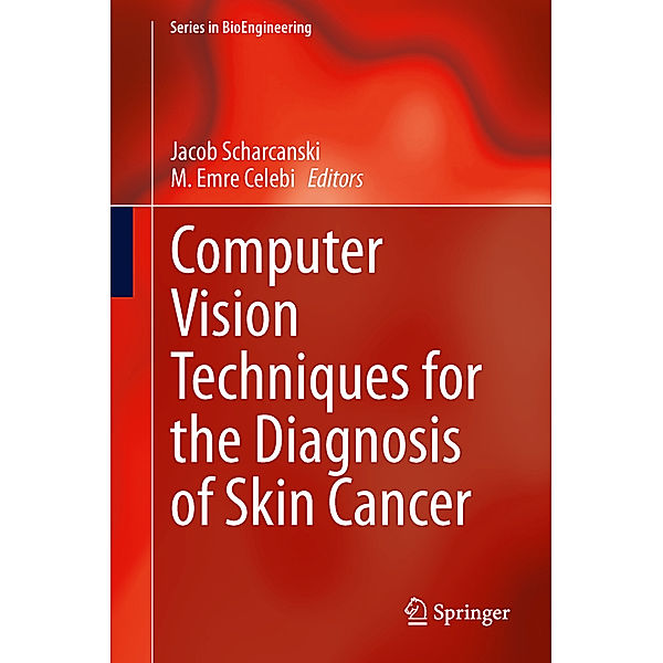 Computer Vision Techniques for the Diagnosis of Skin Cancer