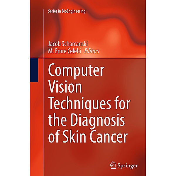 Computer Vision Techniques for the Diagnosis of Skin Cancer