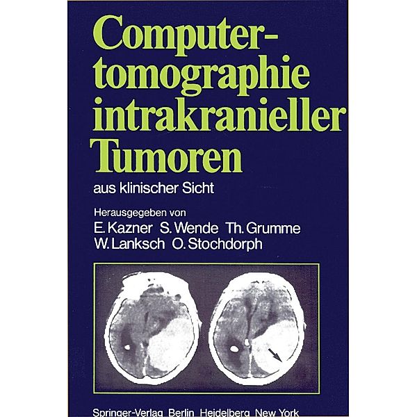 Computertomographie intrakranieller Tumoren aus klinischer Sicht