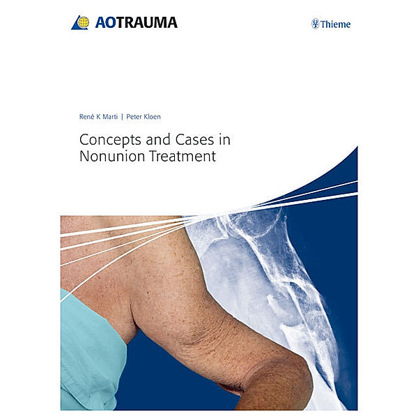 Concepts and Cases in Nonunion Treatment, René K. Marti, Peter Kloen