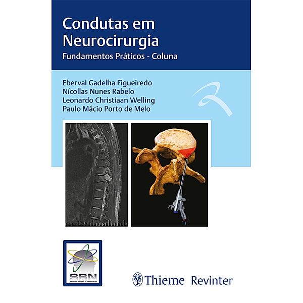 Condutas em Neurocirurgia, Eberval Gadelha Figueiredo, Nícollas Nunes Rabelo, Leonardo Christian Welling