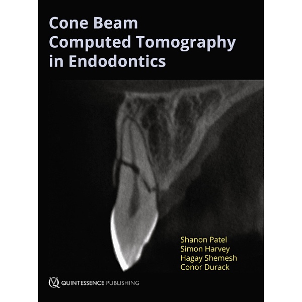 Cone Beam Computed Tomography in Endodontics, Shanon Patel, Simon Harvey, Hagay Shemesh, Conor Durack