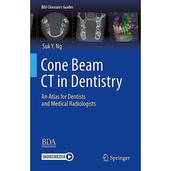 Cone Beam CT in Dentistry / BDJ Clinician's Guides, Suk Y. Ng