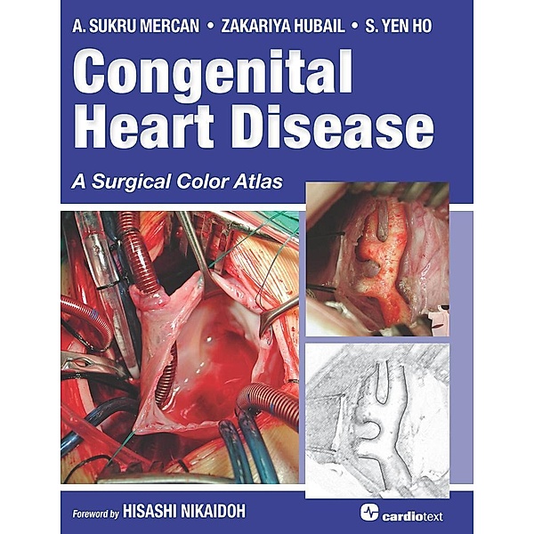Congenital Heart Disease: A Surgical Color Atlas, A. Sukru Mercan, Zakariya Hubail, S. Yen Ho