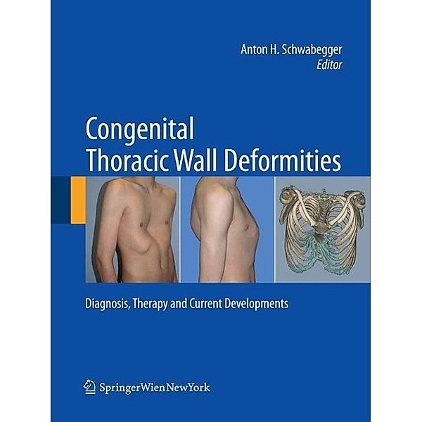 Congenital Thoracic Wall Deformities