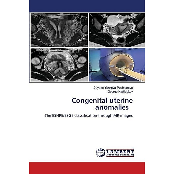 Congenital uterine anomalies, Dayana Yankova-Pushkarova, George Hadjidekov
